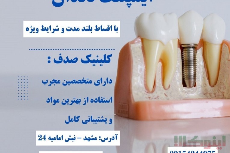 درمان ایمپلنت بدون فشار مالی با اقساط بلند مدت در کلینیک صدف