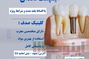 درمان ایمپلنت بدون فشار مالی با اقساط بلند مدت در کلینیک صدف