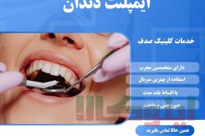 ایمپلنت دندان با کیفیت و عمر طولانی در مشهد