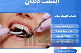 ایمپلنت دندان با کیفیت و عمر طولانی در مشهد
